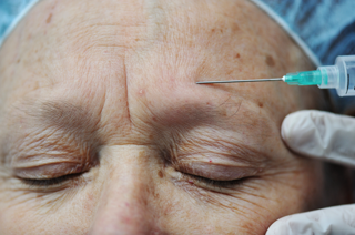 Botox Injects Can Impact The Brain